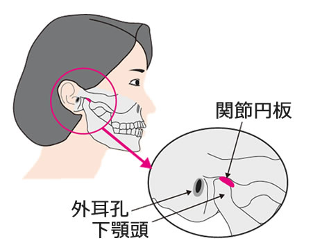 顎関節症 中央歯科医院